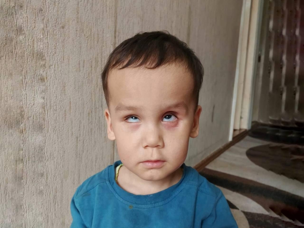 Little Ahmad needs surgery to save his eye and his sight!