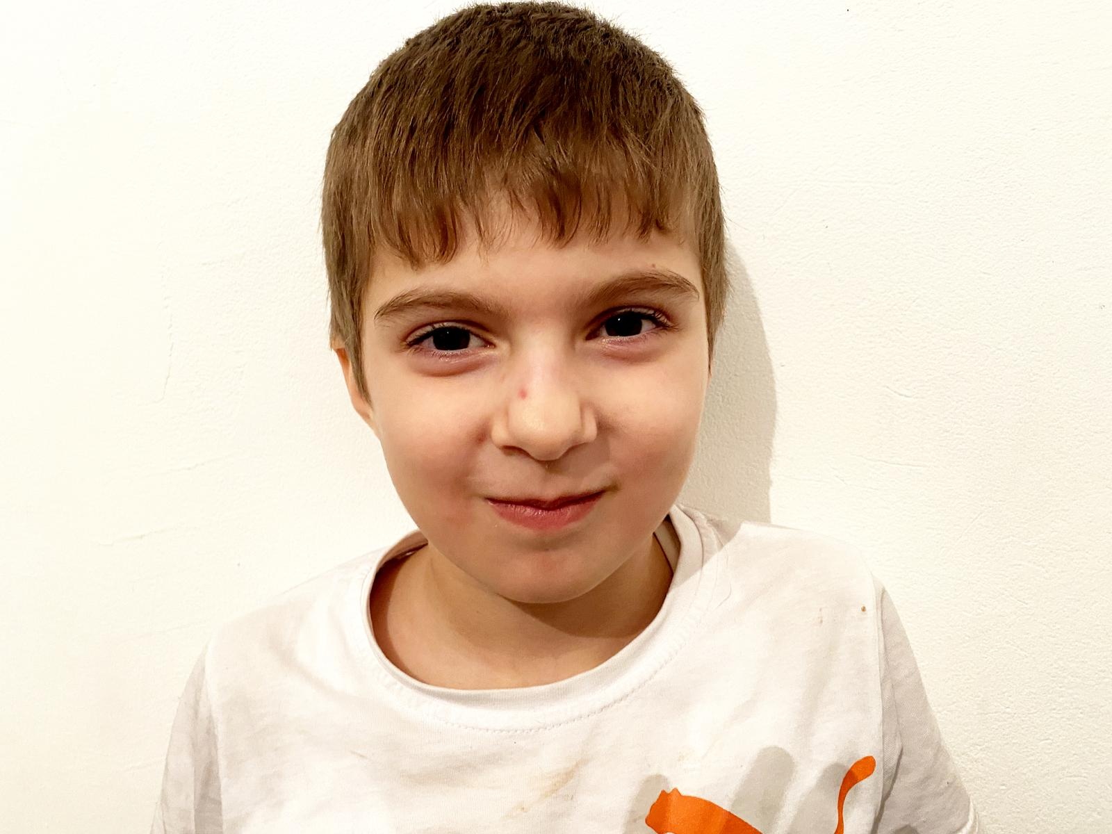 Zubair needs an autism correction course to cope with developmental problems!