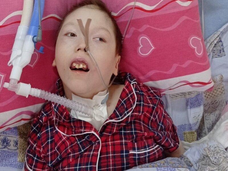 Vicky has a brain defect and needs a battery for ventilation!