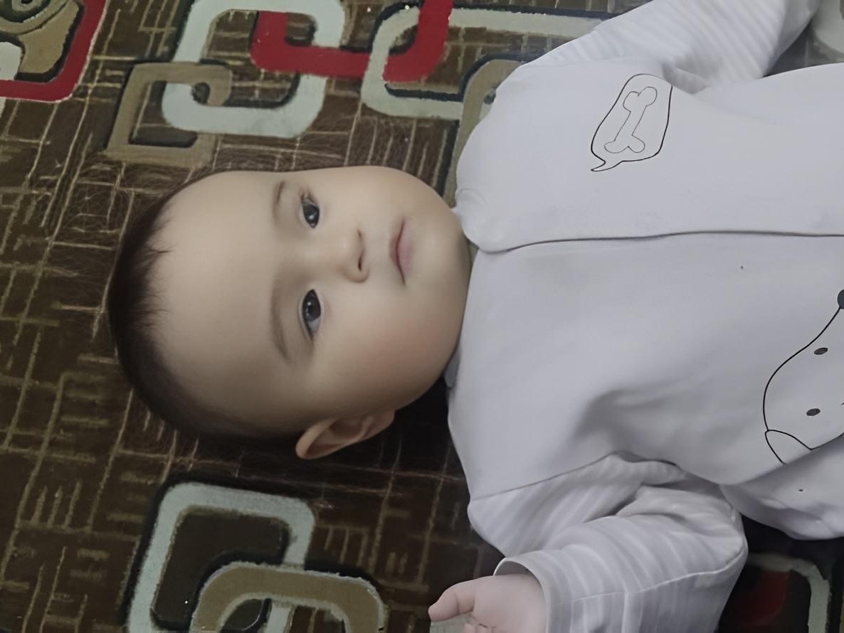 Шарапат нужна операция, чтобы не потерять зрение!