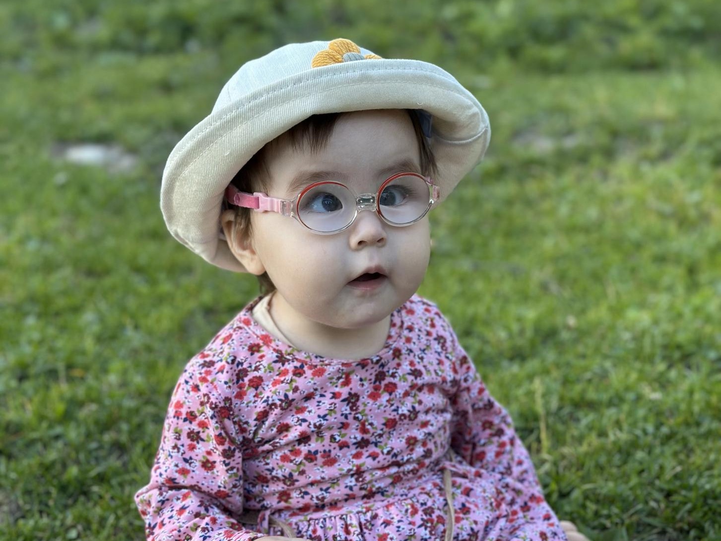 One-year-old Albina needs eye surgery to see!