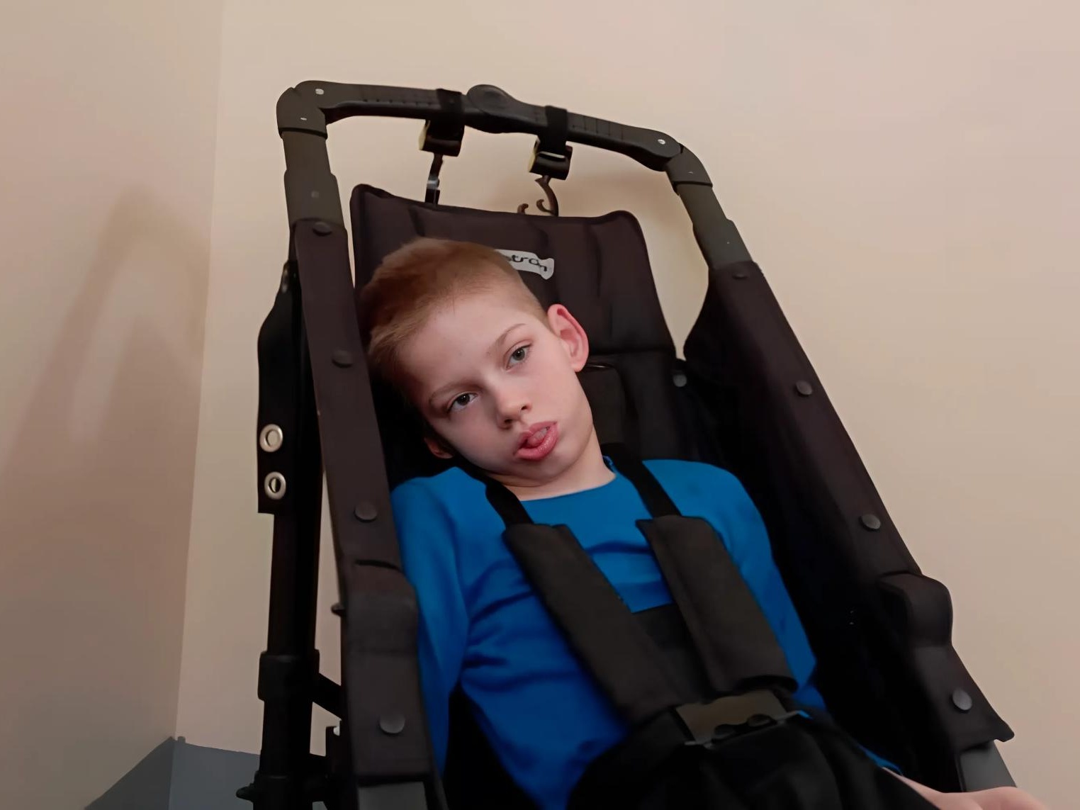 Disabled children require medical nutrition