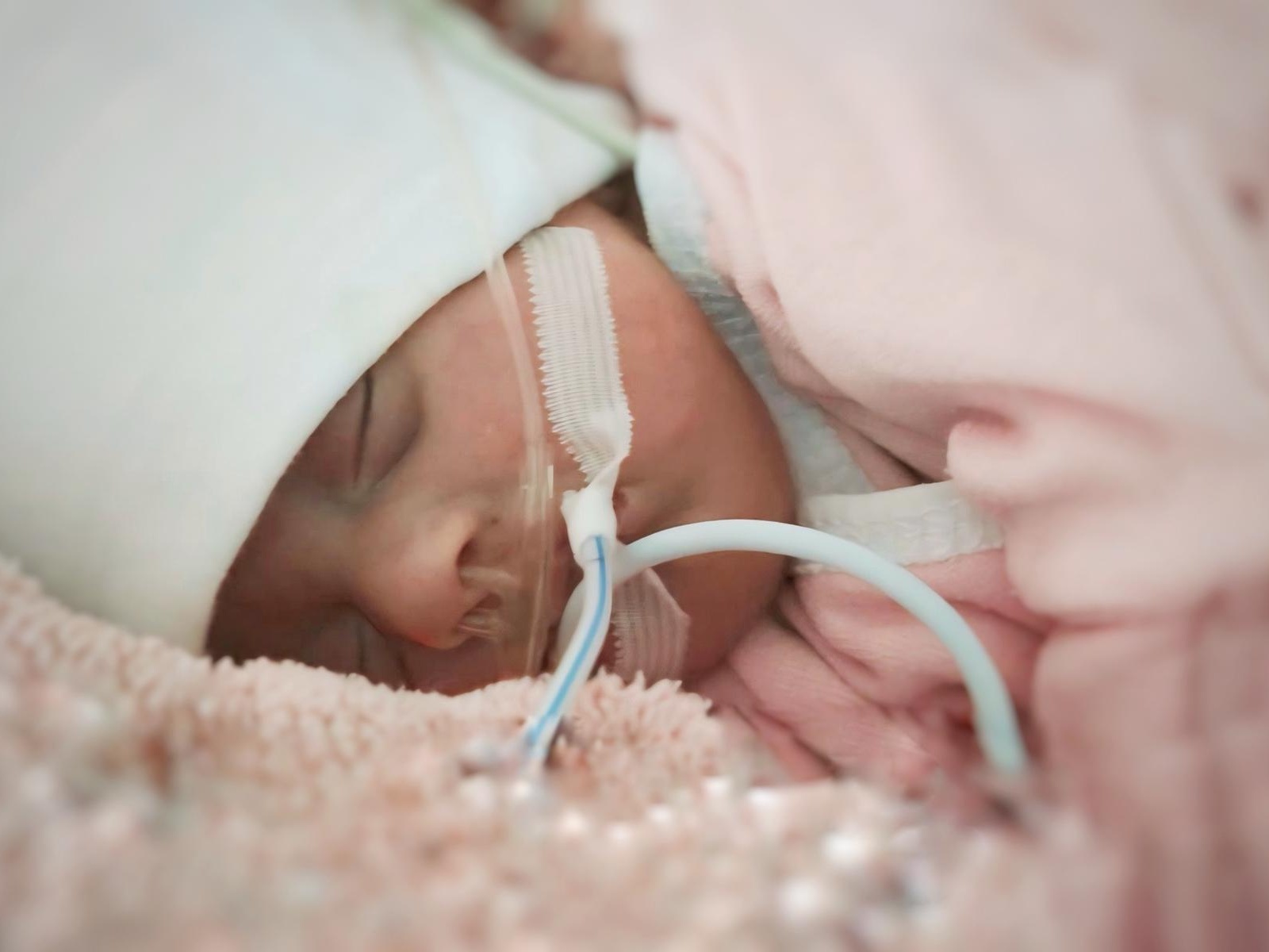 Dilnoza is in intensive care. Let's help the little girl to get to the surgery and save her eyesight!