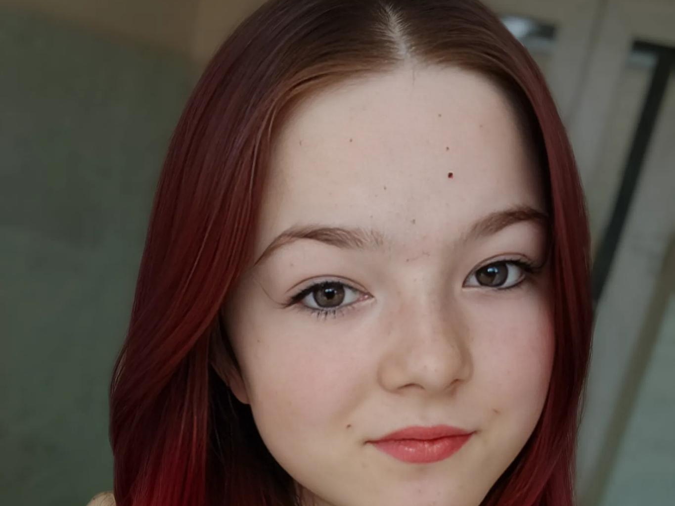 After heart surgery, Anya needs a machine to monitor her blood clotting parameters