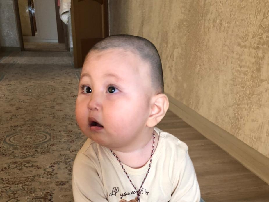 One-year-old Madiyar needs another surgery so he can see!