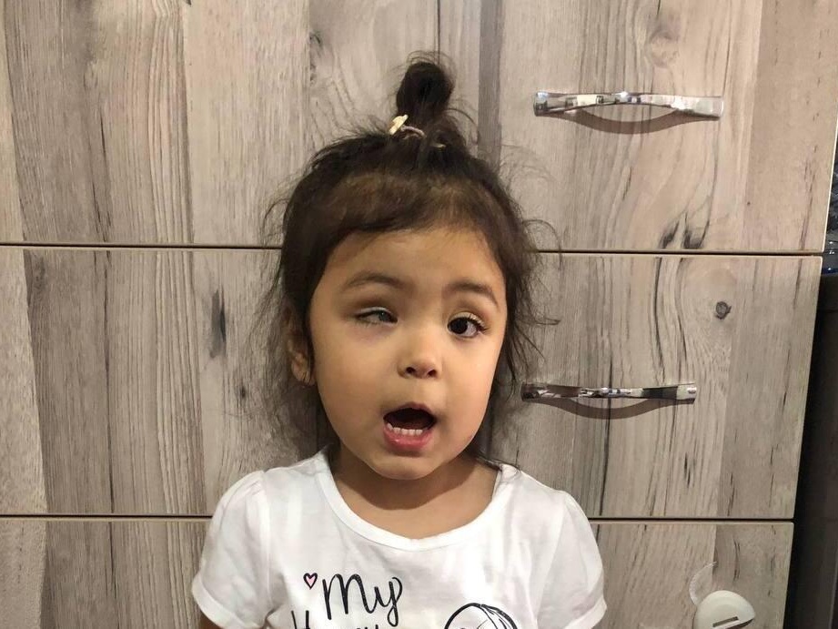 Help save three-year-old Sofiyakhon's eye!