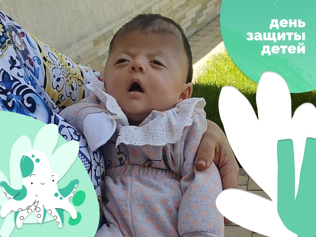 Little Sora needs surgery to separate her fingers and toes.
