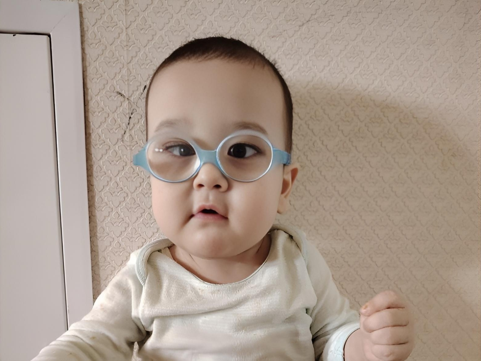 One-year-old Alikhan needs surgery on his right eye to preserve his ability to see