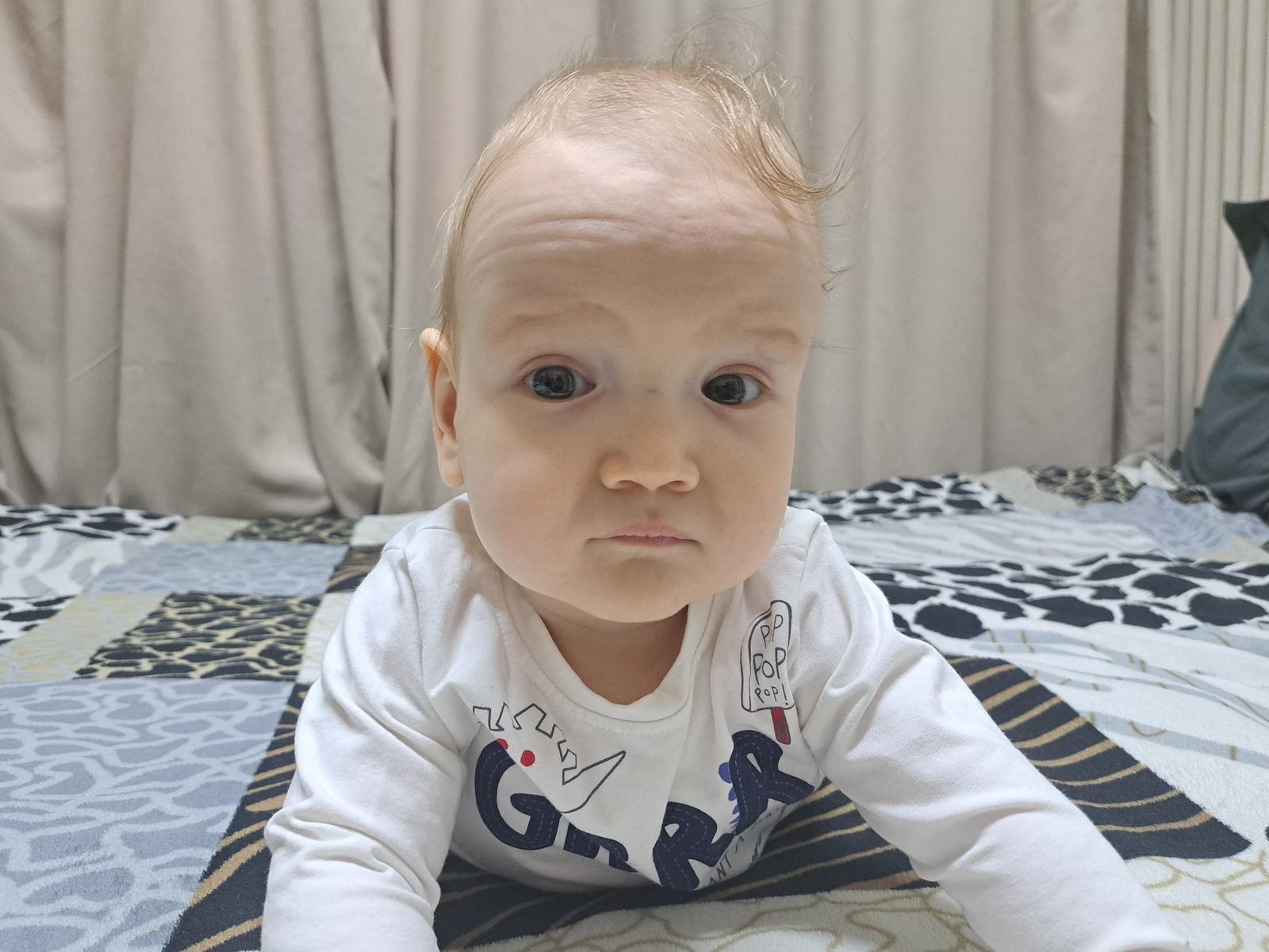 Ilya needs an operation on his skull.