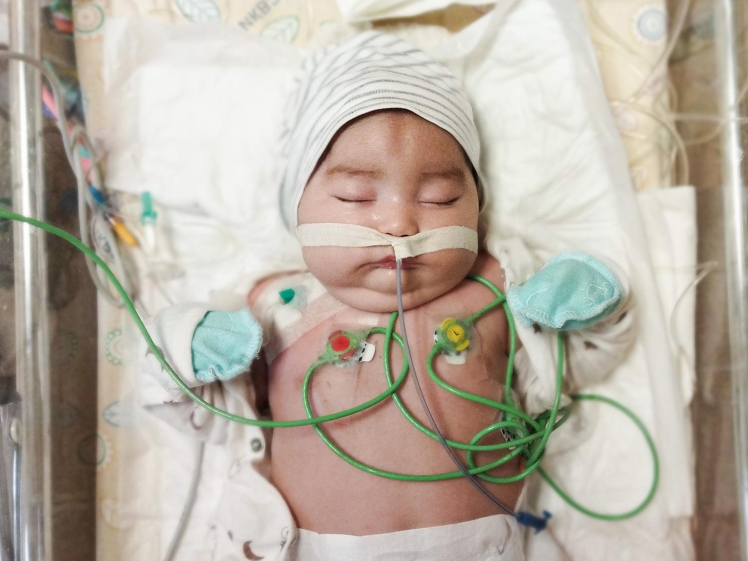 Muhammadusmon has a blood clotting disorder and needs expensive treatment!
