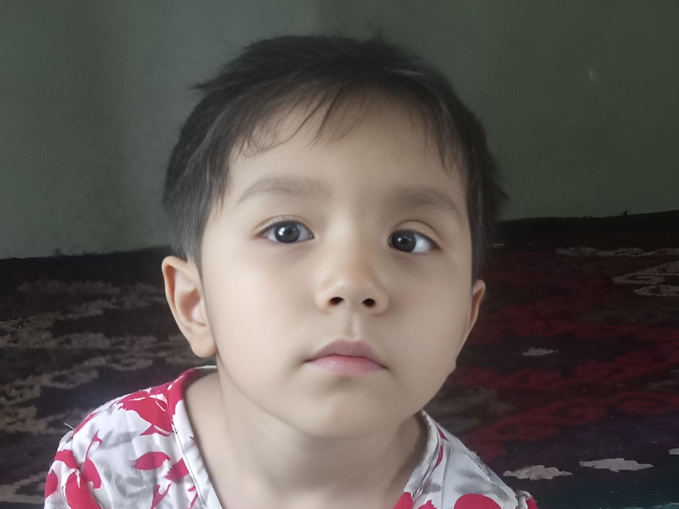 Dilnoora needs surgery to see better