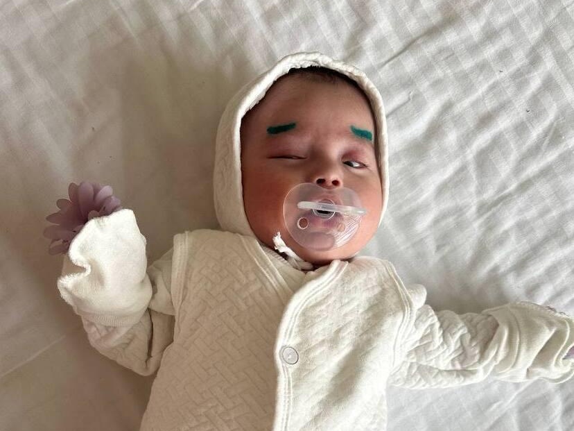 Let's help save little Afruza's eyesight! The little one needs surgery