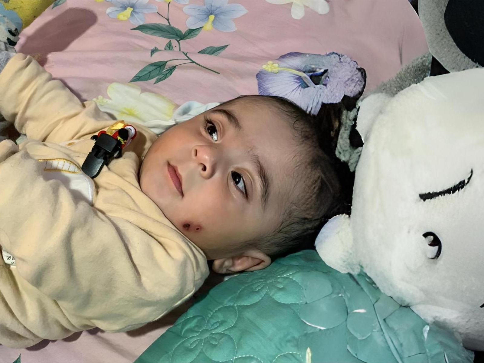 Eight-month-old Muhammad needs eye surgery