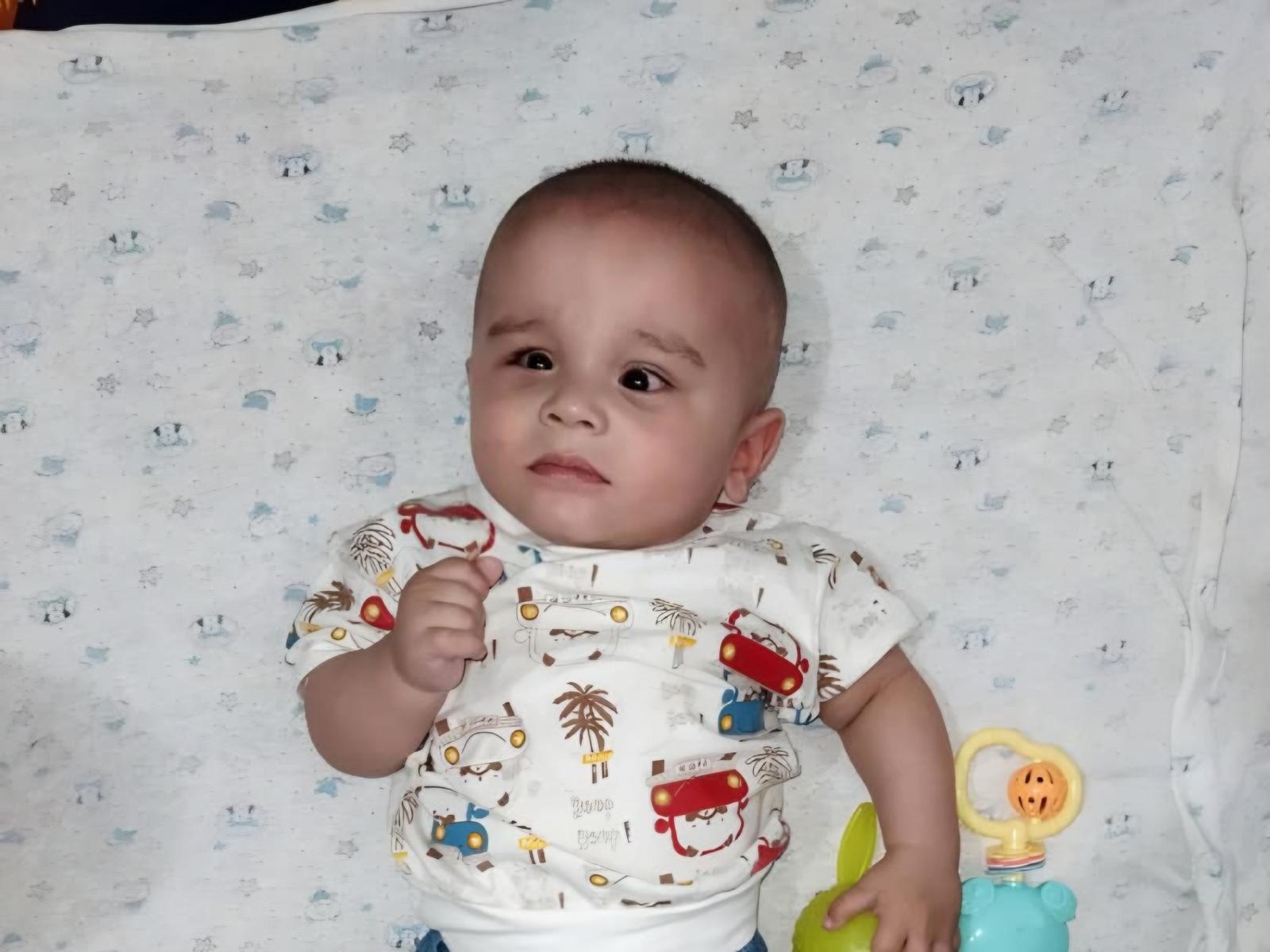 One-year-old Mustafa has retinopathy, he needs surgery!