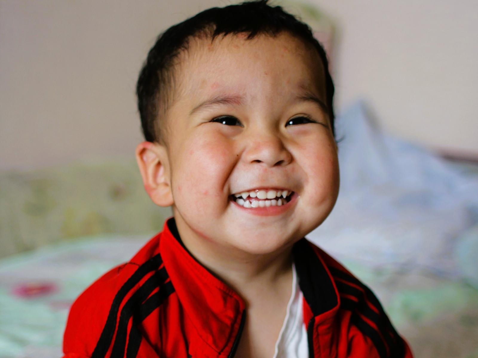 Save little Ibrohim's eye!