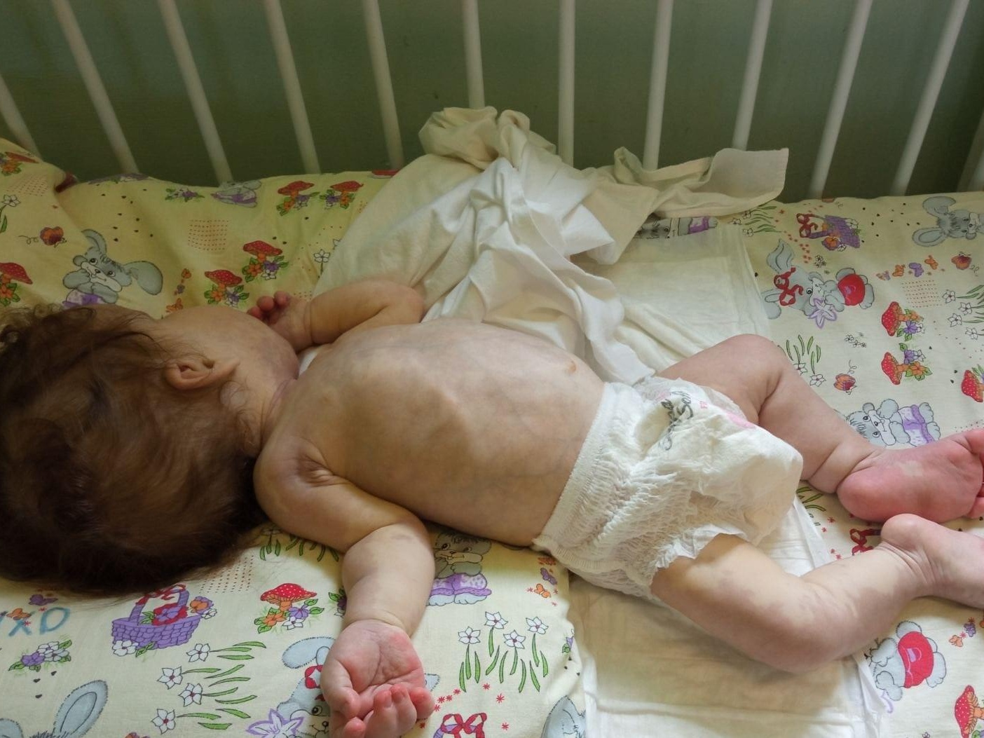 Sofia is an orphan. The baby needs the help and support of a babysitter during treatment in the hospital!