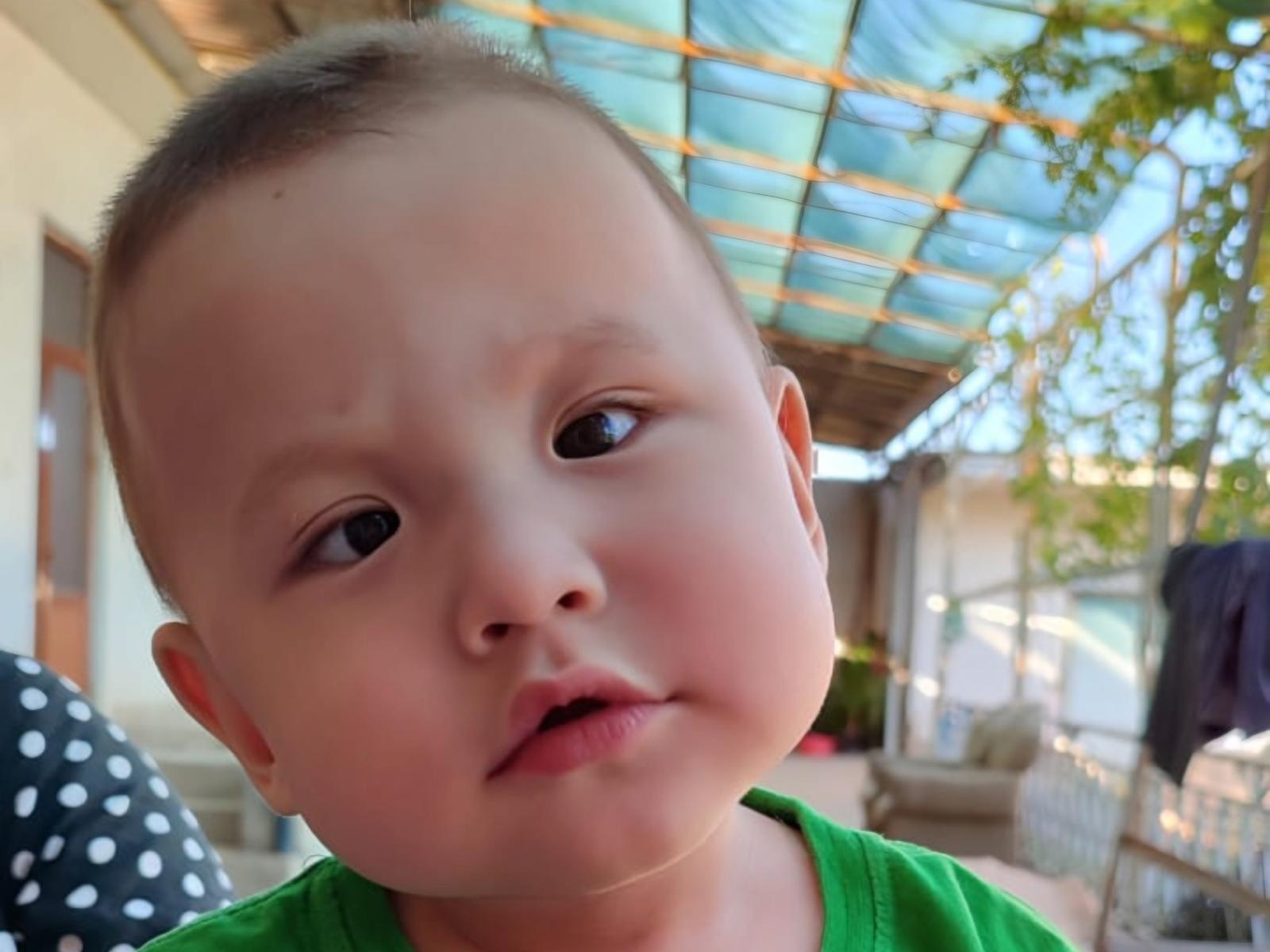 Little Asyl has a congenital cataract, he needs surgery!