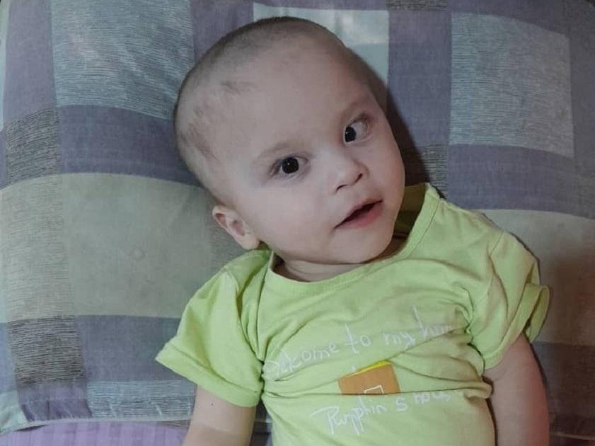 One-year-old Muhammadumar has a retinopathy – baby needs surgery to keep being able to see