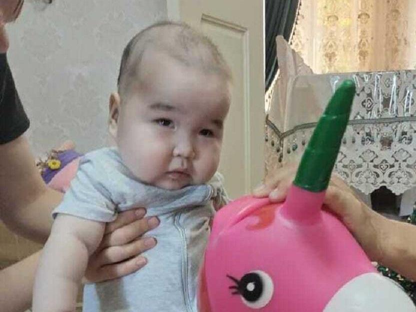 Мухаммедали не видит. Малышу нужна операция, чтобы восстановить зрение!
