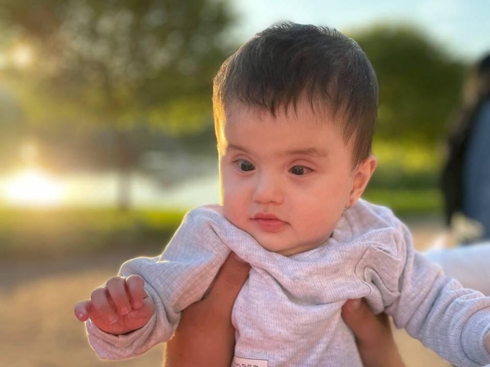 Afruza needs another operation against retinopathy of prematurity. Let's help the girl to see!