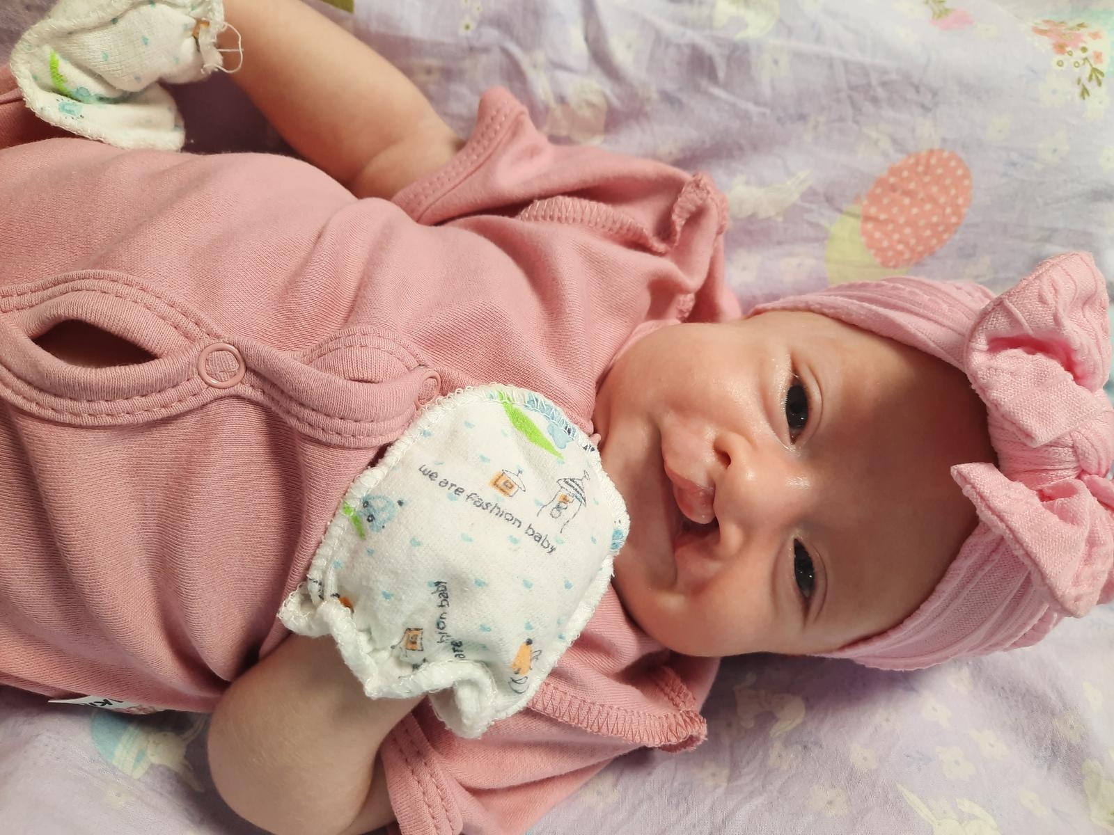 Eva was born with a cleft upper lip and alveolar process of the upper jaw - the girl needs surgery