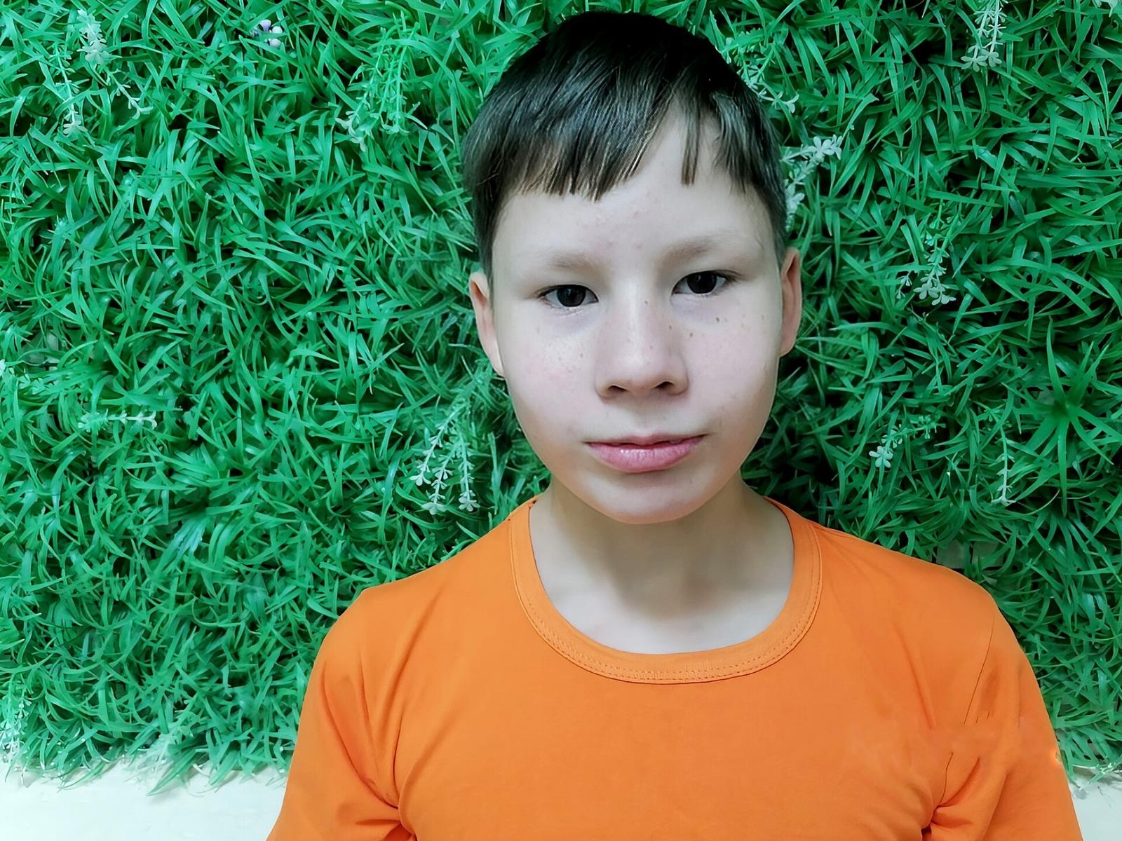 Roma is an orphan. He has serious orthopedic problems - now he needs to come to the doctor for surgery