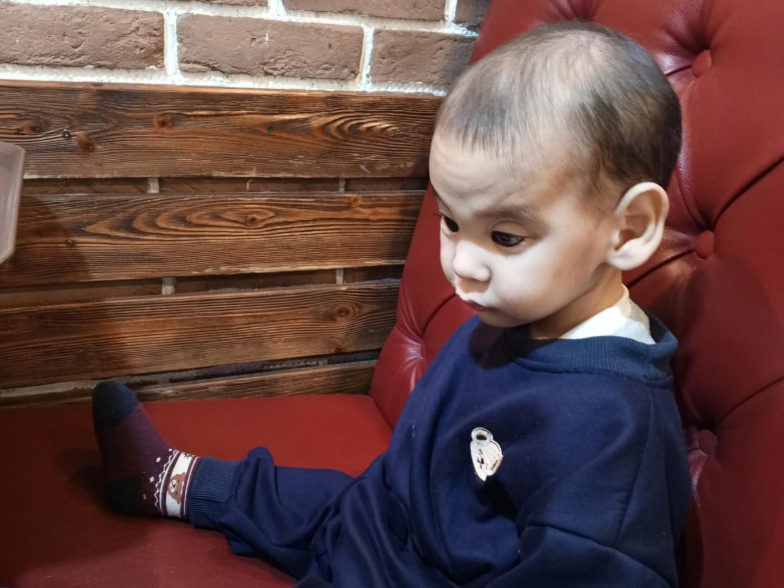 Daryn has cataracts and glaucoma – he needs surgery