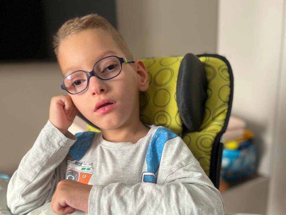 Emil needs surgery to correct his strabismus to stop his vision from deteriorating and to see with both eyes