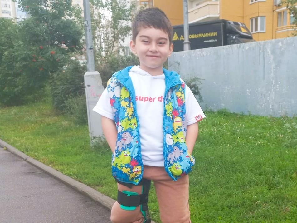 Ibrohim has a tibial aplasia, needs surgery