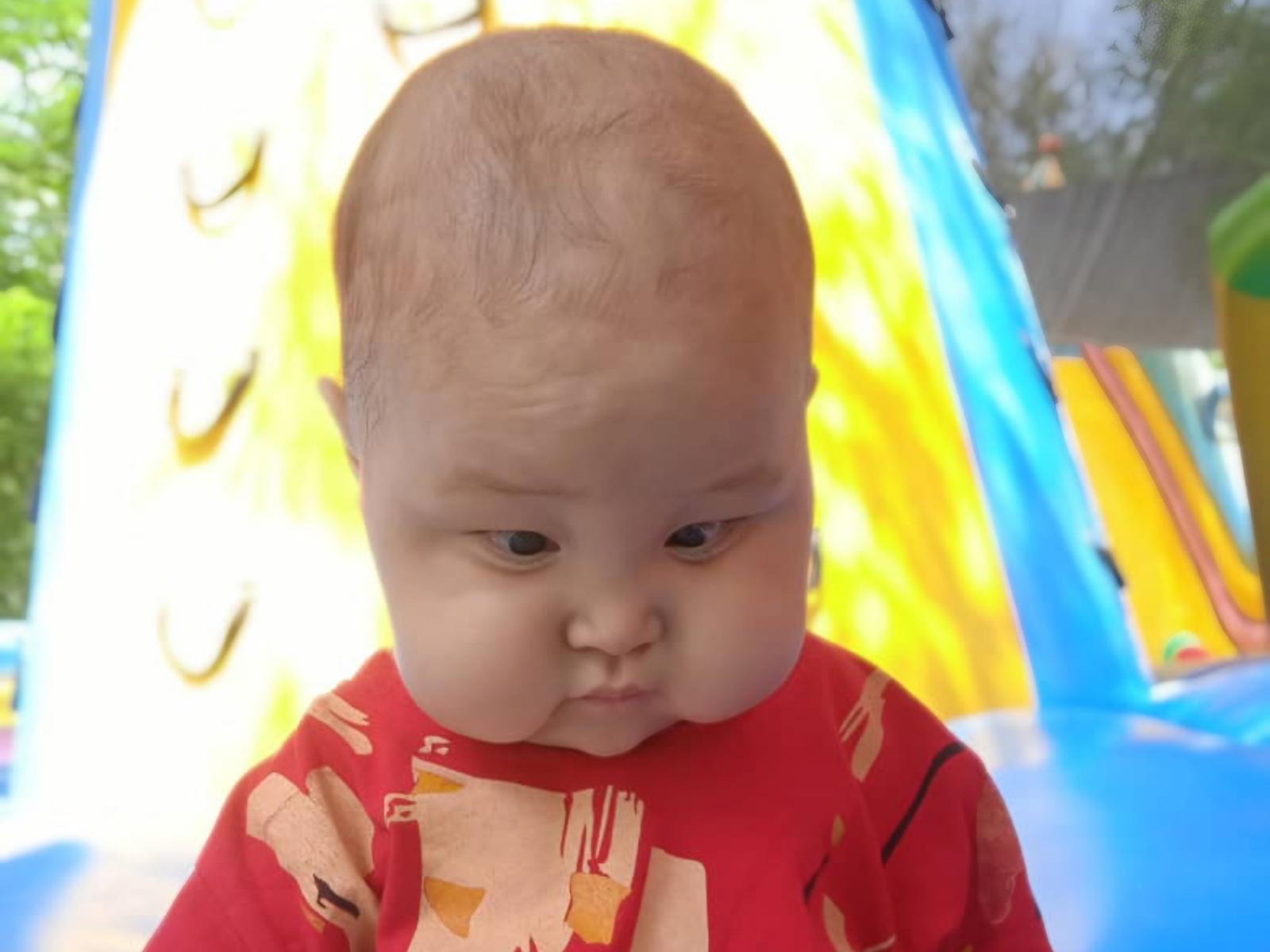 Bekbolsun has retinal detachment, he needs surgery to preserve his vision!
