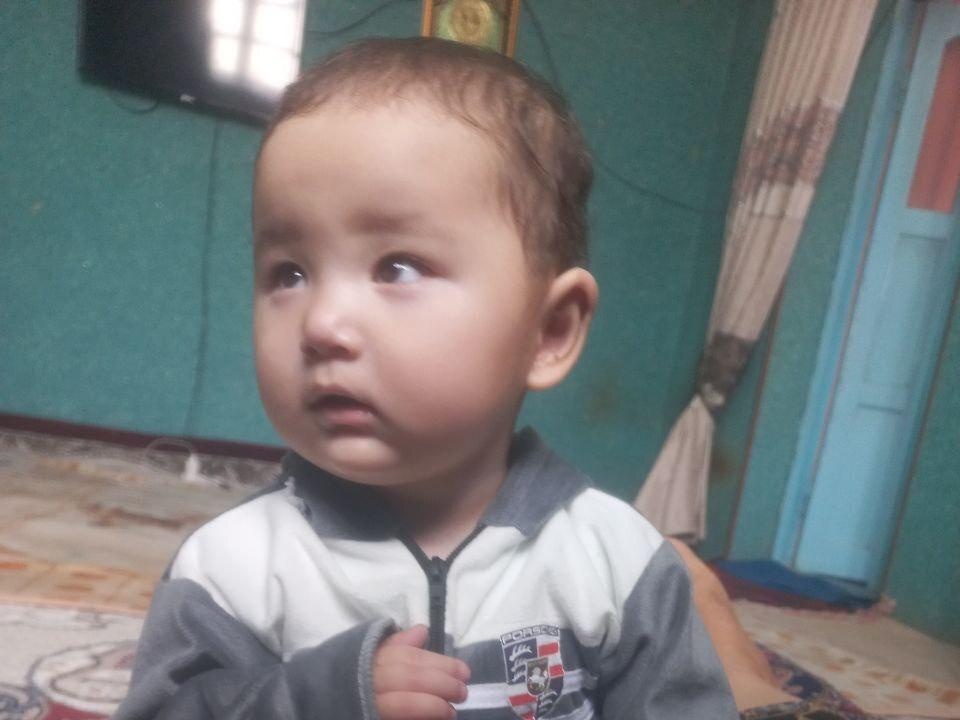 Zukhra has retinopathy of prematurity and needs surgery