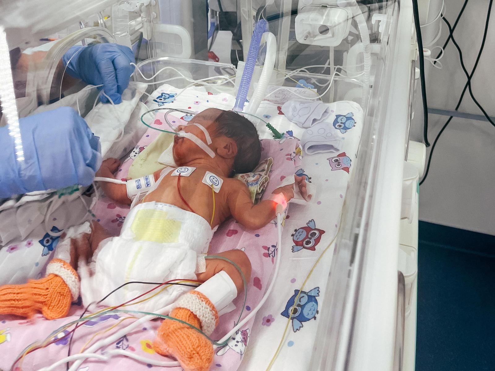 Alim, one of the newborn twins, needs heart surgery!