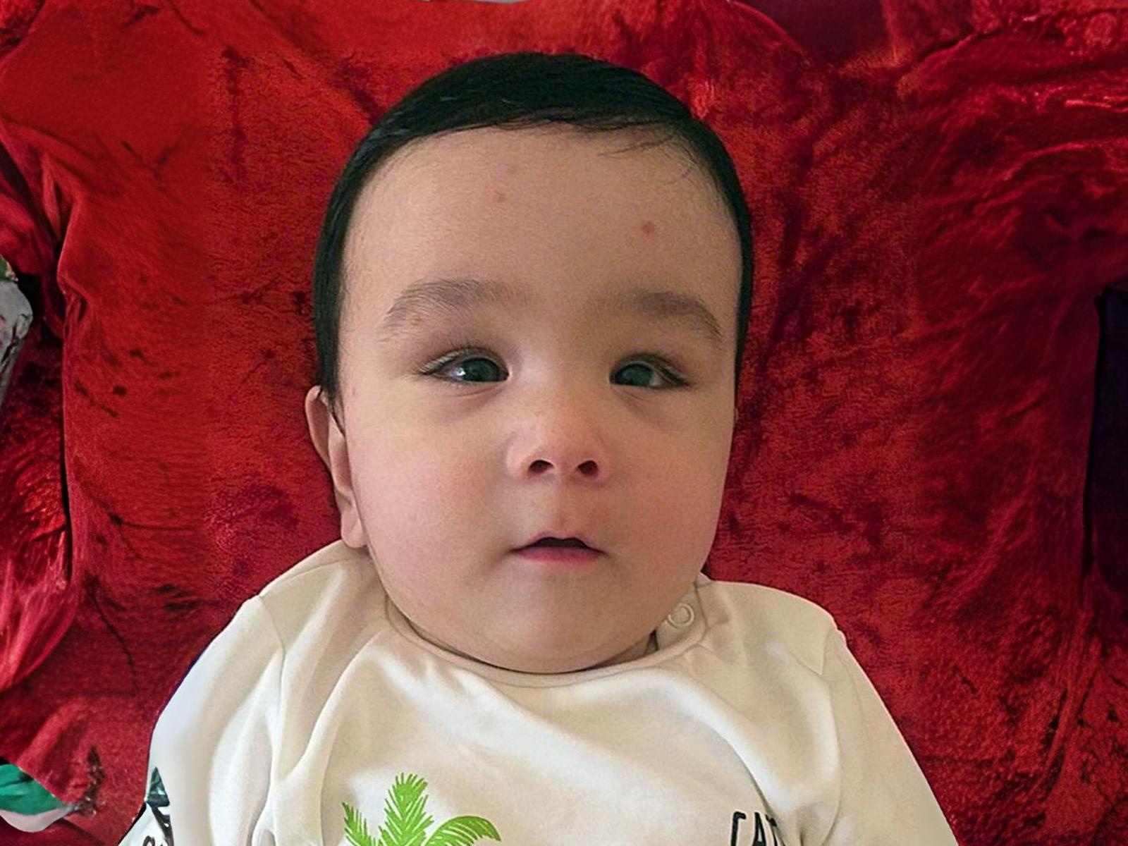 Salimjon needs surgery to save his eye