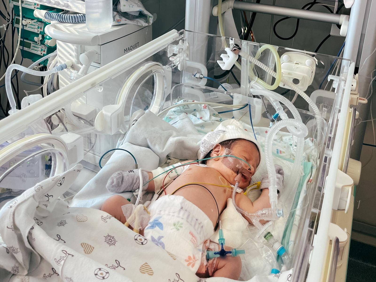 Baby Muhammad Solih needs heart surgery!
