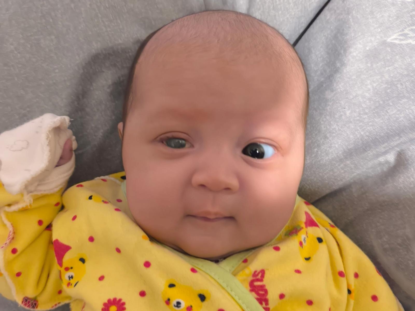 Istoda needs surgery to save her eye
