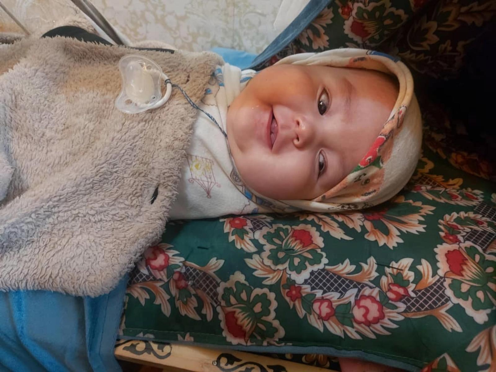 Muhammad needs surgery to preserve his eye and visual functions