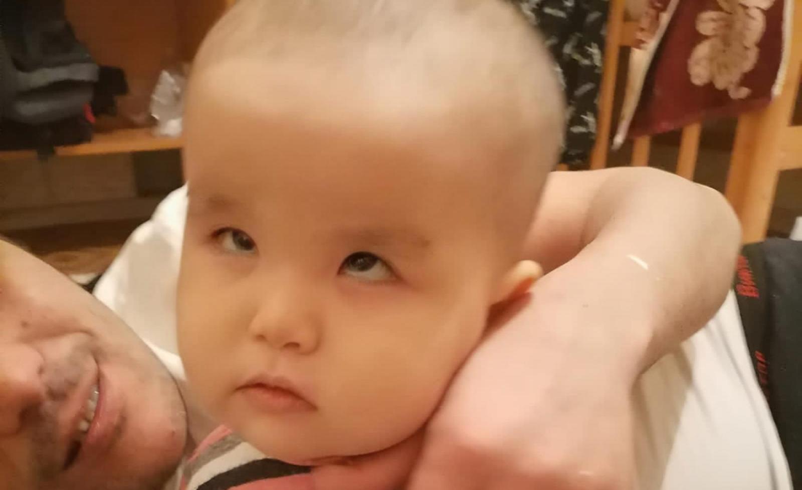 Dune has retinal detachment — she needs surgery to preserve her eye and visual functions