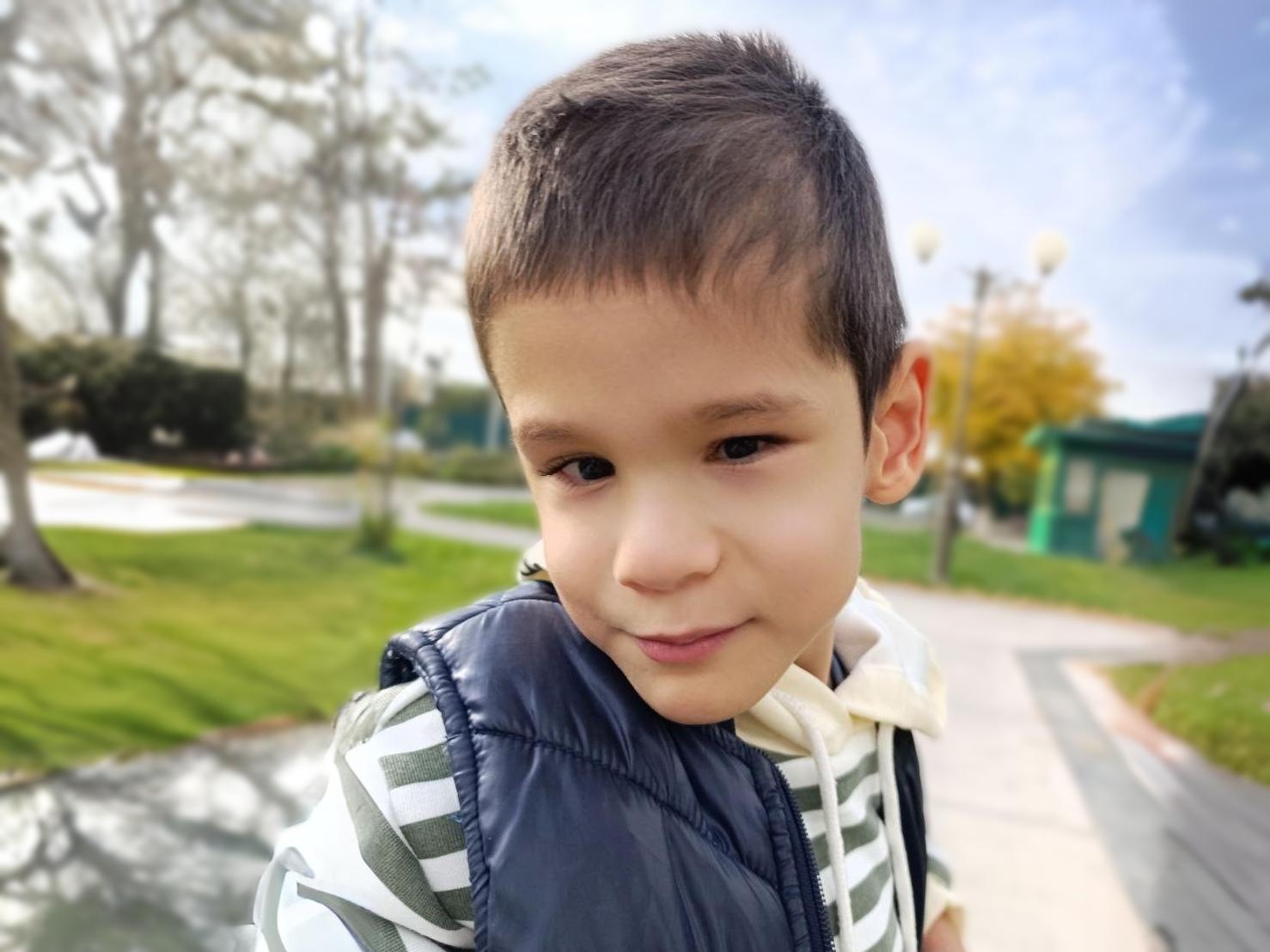 Imron has retinal detachment, he needs surgery to preserve his vision