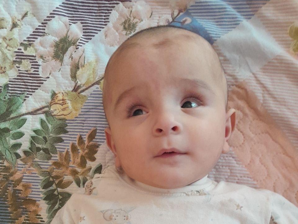 Husen needs surgery to restore his eyesight
