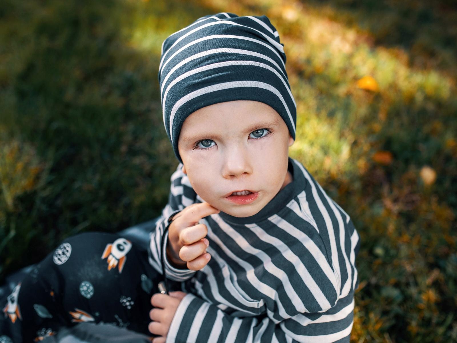 Egor needs surgery to restore his facial expressions