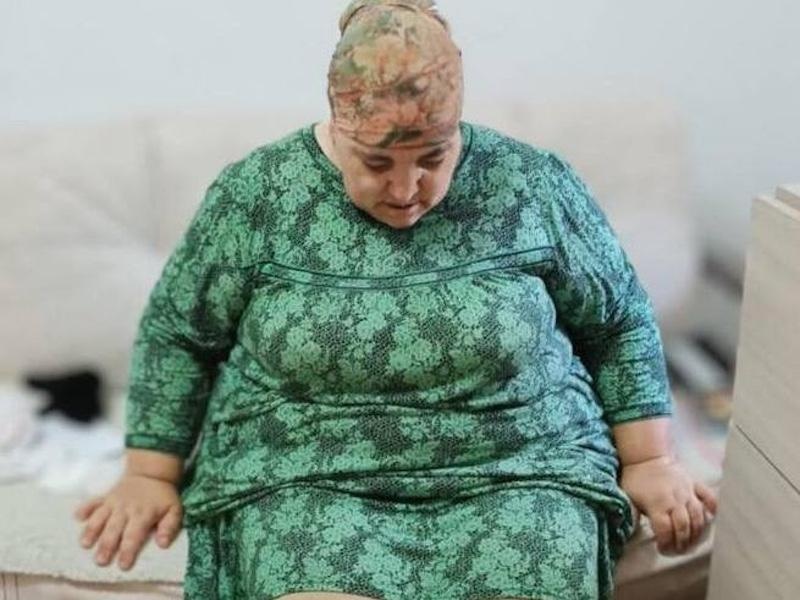 Asset needs compression stockings after surgery to remove lymphodema!