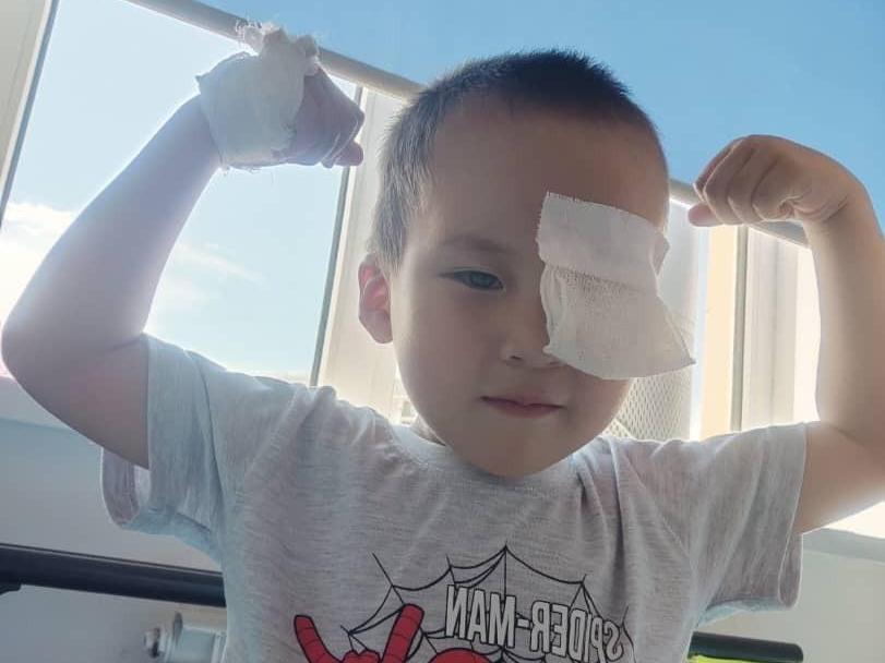Umar needs eye surgery after an injury