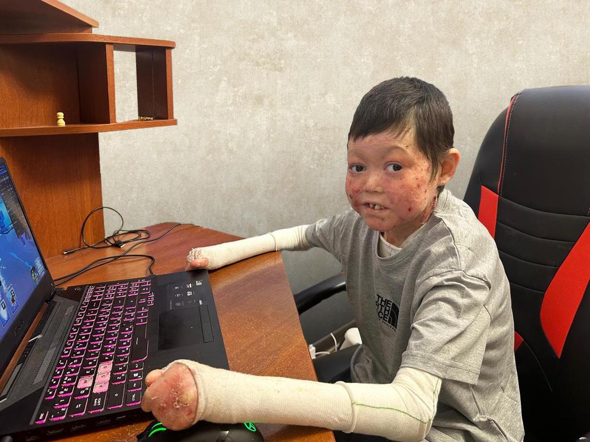 Ahmad has a genetic disease. He needs bandages to protect his skin!