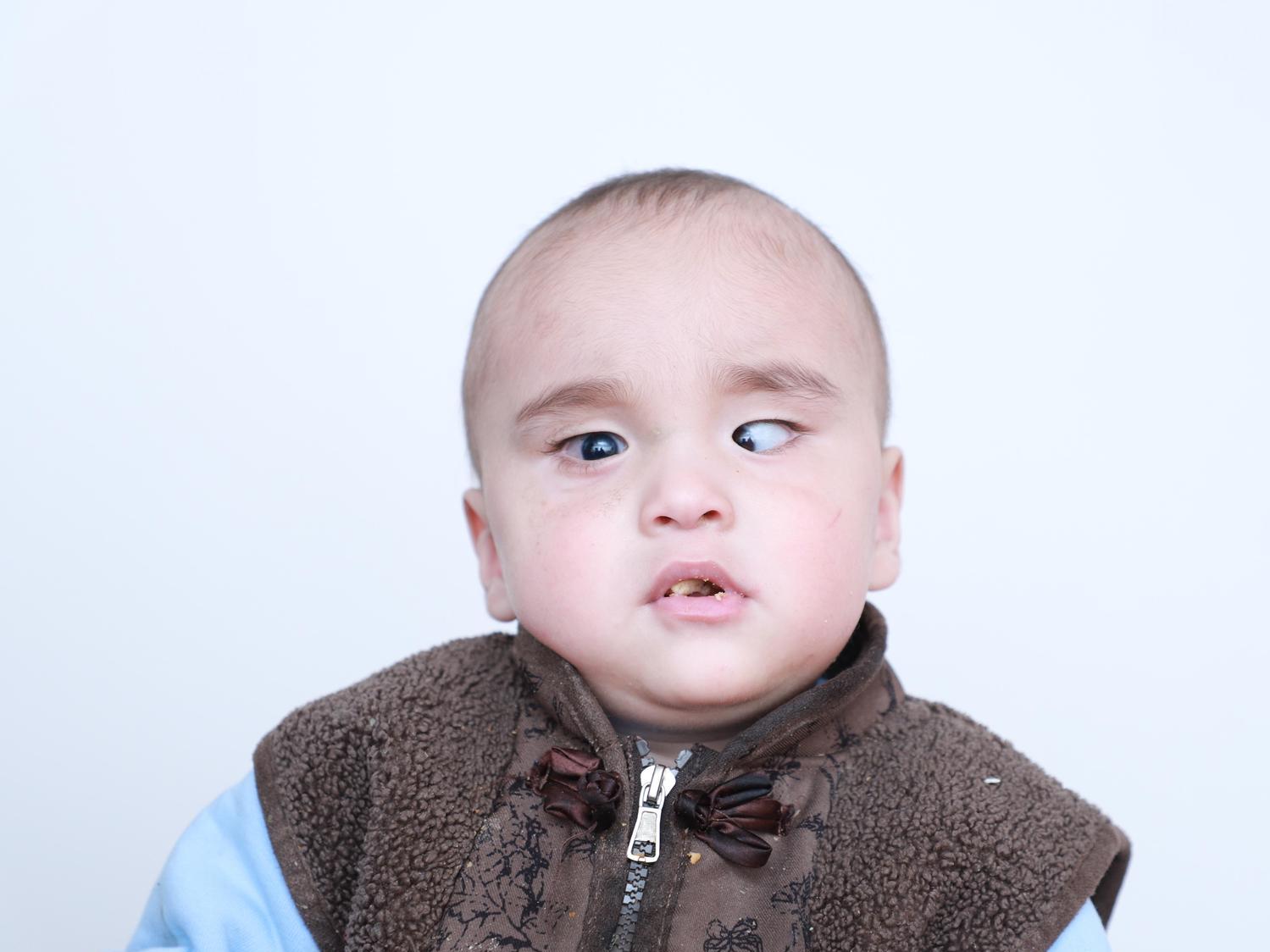 Emir needs to continue treatment to restore his eyesight!