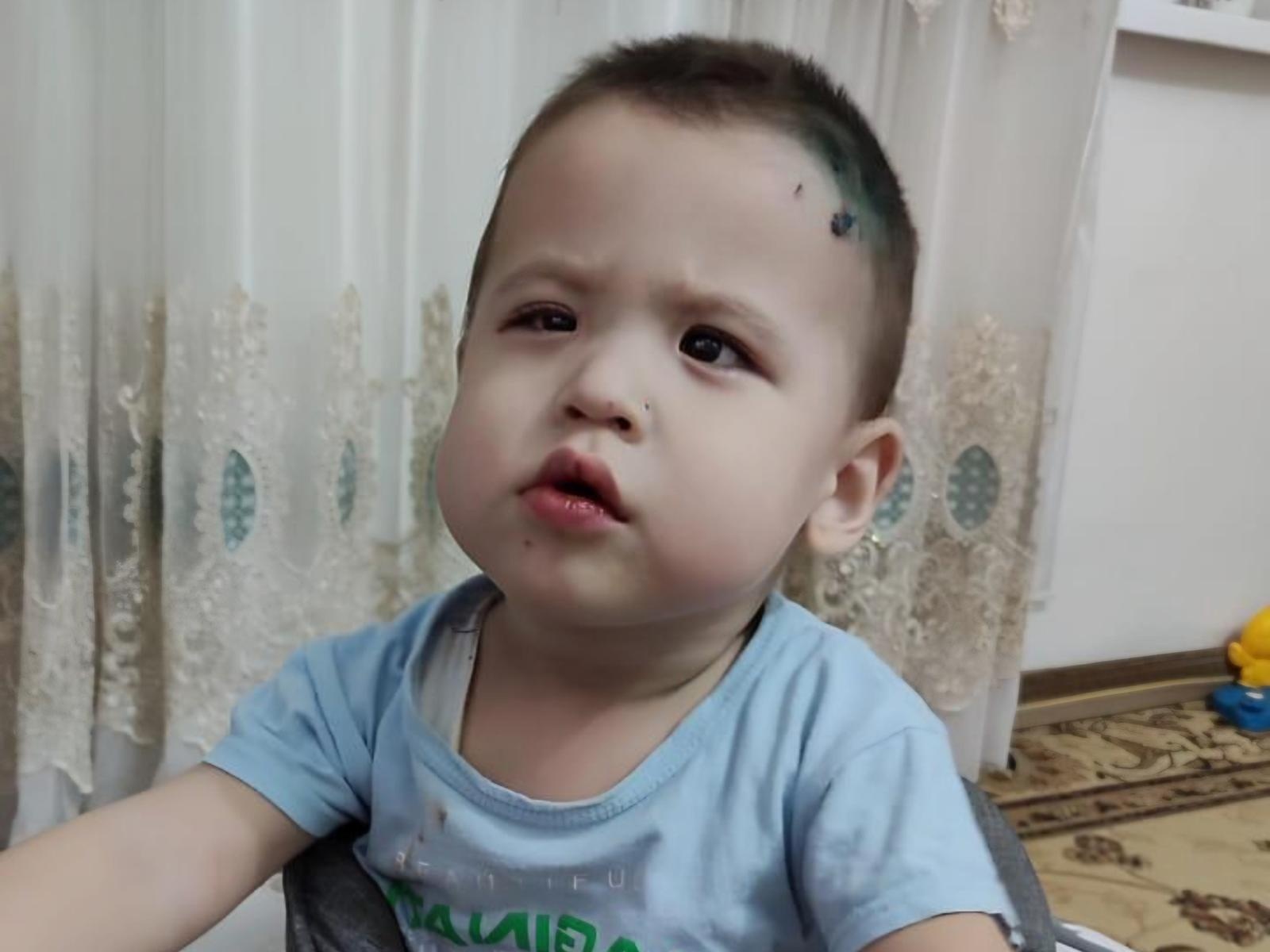 Asyl has a congenital cataract, he needs surgery to preserve his eyesight