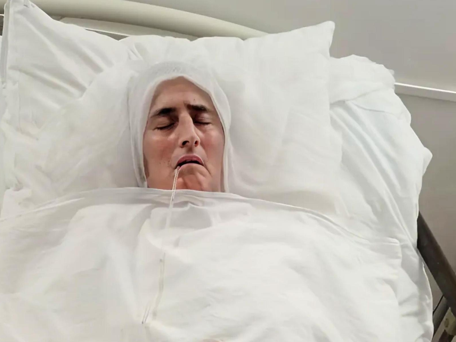 Ashat needs rehabilitation after a severe head injury!