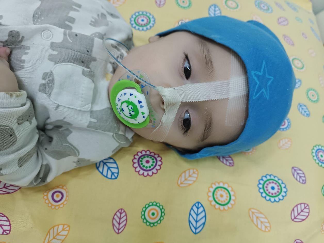 After the operation, Usmon was recommended special glasses