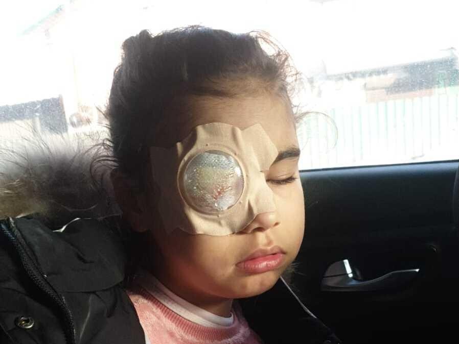 Shikhirizadeh requires more surgery after cornea transplantation
