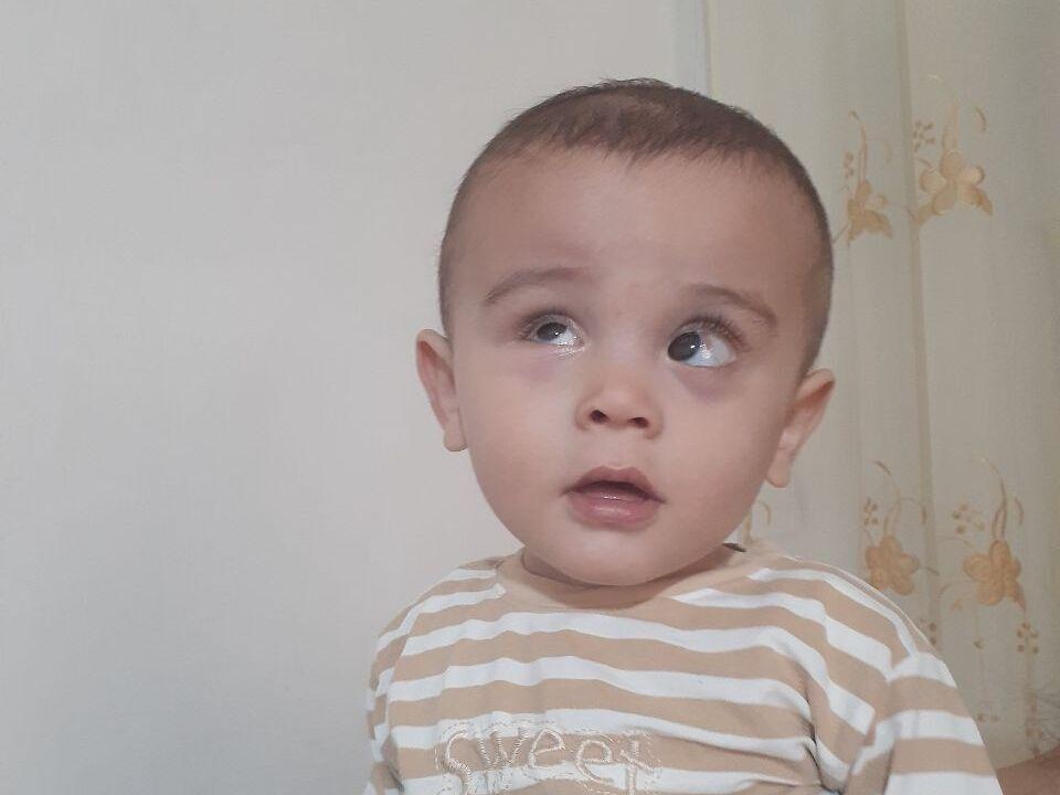 Mustafo has been recommended surgery on the other eye to treat retinopathy of prematurity