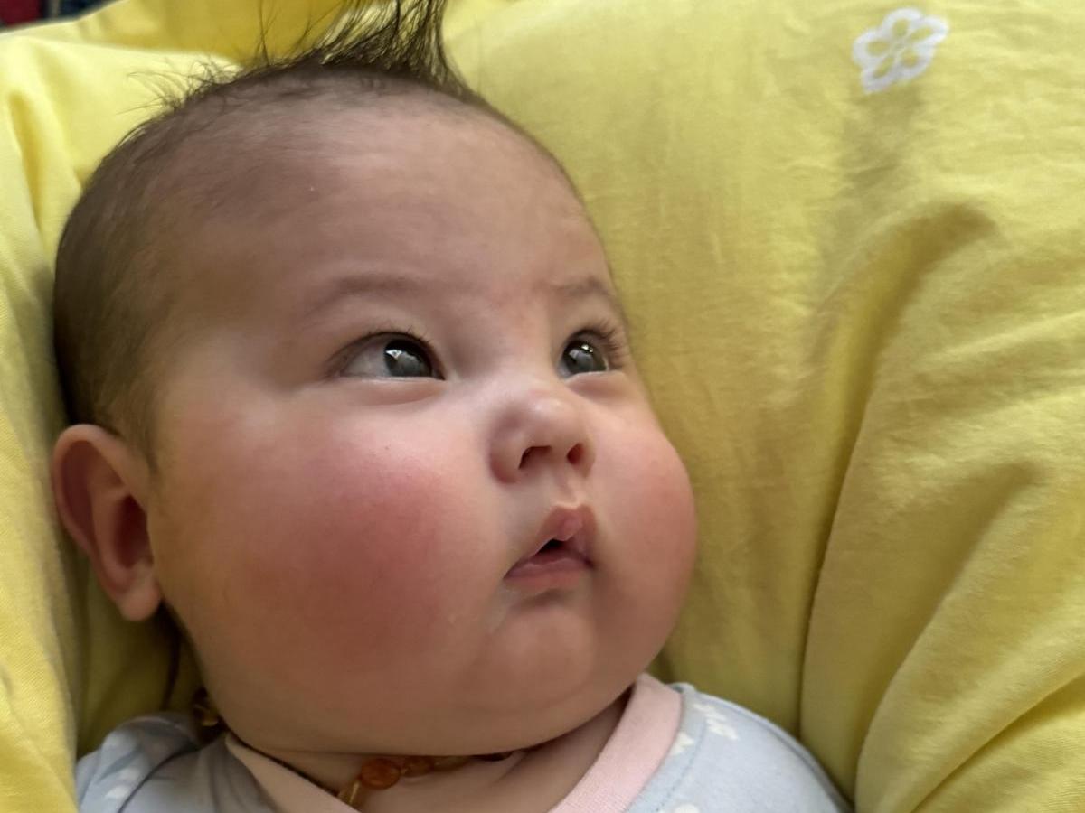 Saafia needed surgery to treat retinopathy of prematurity